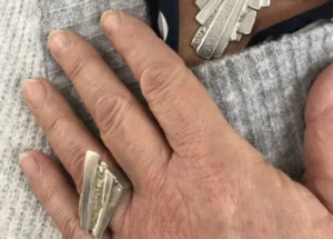 ring-NvH